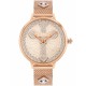 Ceas Dama, Police, Socrota P16031MSR32MMA